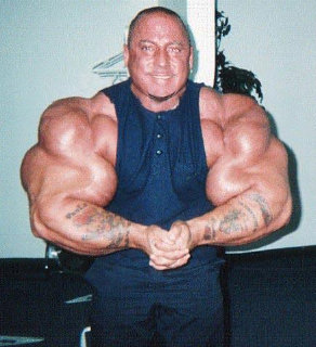 Explotan los brazos de Greg Valentino debido al Synthol